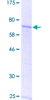 12.5% SDS-PAGE Stained with Coomassie Blue.